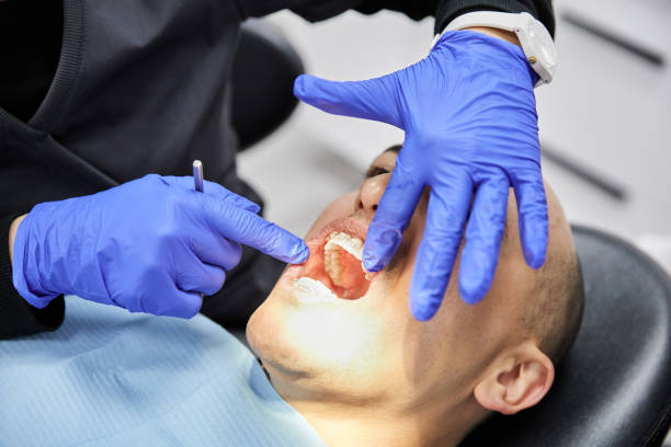 Best Teeth Whitening  in Le Mars, IA
